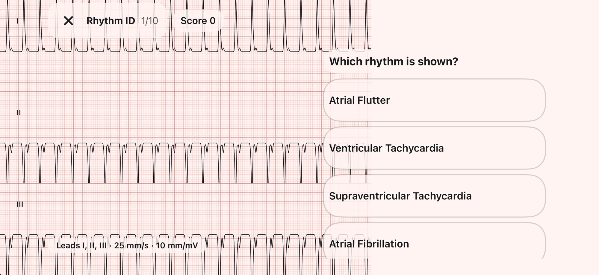 A Rhythm ID question on an iPhone: a fast wide-complex tracing on leads I, II and III at 25 mm/s and 10 mm/mV, with four answers to choose from.